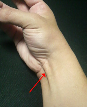 �`���[���؁B